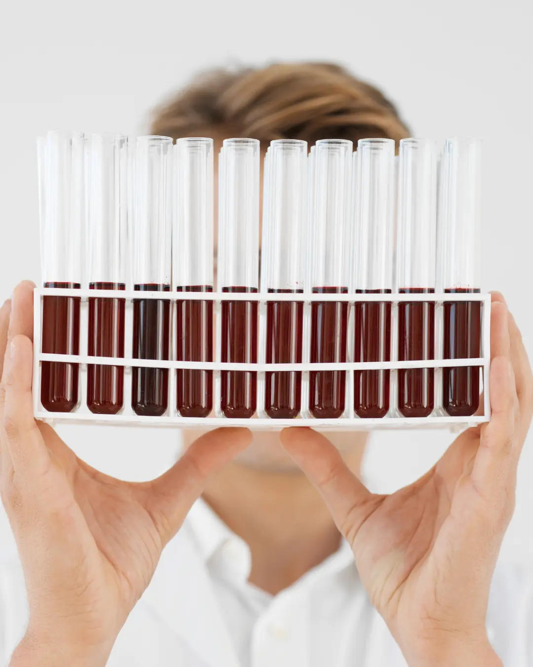 Nutrition Blood Tests
