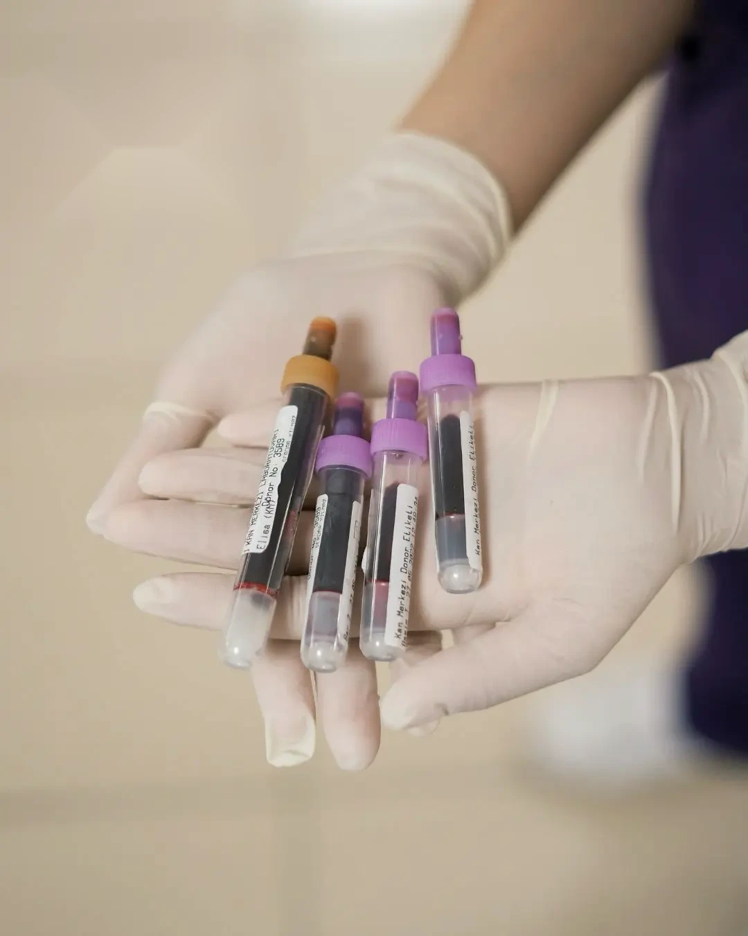 Blood tests at IV Health Care in Bournemouth